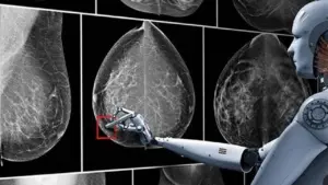 تجاریسازی سامانه تشخیص سرطان سینه با دقت بالای ۹۸ درصد در کشور